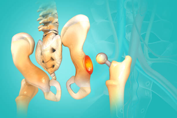 Best Hip Replacement Surgeon in sangamner